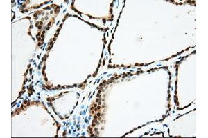 Immunohistochemical staining of paraffin-embedded Human Kidney tissue using anti-USP5 mouse monoclonal antibody. (USP5 Antikörper)