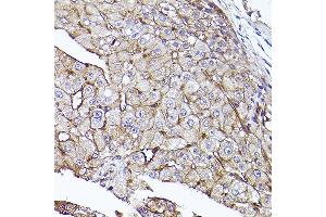Immunohistochemistry of paraffin-embedded human liver using [KO Validated] CD73/NT5E Rabbit pAb (ABIN3022733, ABIN3022734, ABIN3022735, ABIN1513283 and ABIN6219201) at dilution of 1:50 (40x lens). (CD73 Antikörper  (AA 290-550))