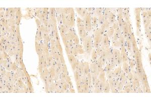 Detection of CD40L in Human Cardiac Muscle Tissue using Monoclonal Antibody to Cluster Of Differentiation 40 Ligand (CD40L) (CD40 Ligand Antikörper  (AA 48-244))