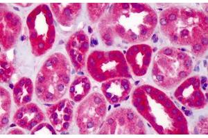 Human Kidney: Formalin-Fixed, Paraffin-Embedded (FFPE) (SLIT1 Antikörper  (AA 487-504))