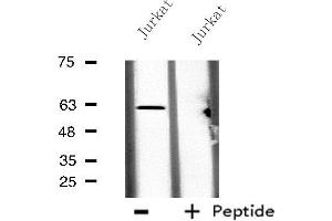 Western blot analysis of extracts from Jurkat cells, using CES2 antibody. (CES2 Antikörper  (N-Term))