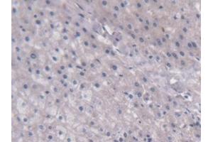 Detection of UCP2 in Human Liver Tissue using Monoclonal Antibody to Mitochondrial Uncoupling Protein 2 (UCP2) (UCP2 Antikörper  (AA 154-289))