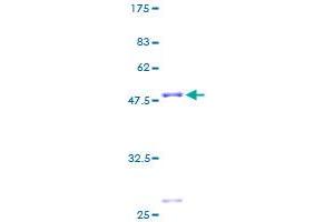 MRPL22 Protein (AA 1-206) (GST tag)