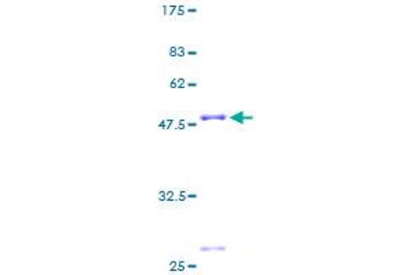 MRPL22 Protein (AA 1-206) (GST tag)