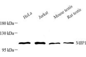 Western blot analysis of N4BP1 (ABIN7074790),at dilution of 1: 1000,Lane 1: HeLa cell lysate,Lane 2: Jurkat cell lysate,Lane 3: Mouse testis tissue lysate,Lane 4: Rat testis tissue lysate (N4BP1 Antikörper)
