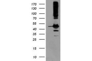 Western Blotting (WB) image for anti-serpin Peptidase Inhibitor, Clade B (Ovalbumin), Member 13 (SERPINB13) antibody (ABIN1500877) (SERPINB13 Antikörper)