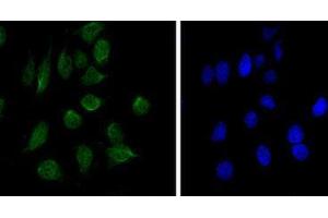 Immunocytochemistry (ICC) image for anti-Chromodomain Helicase DNA Binding Protein 3 (CHD3) antibody (ABIN2983311) (CHD3 Antikörper)