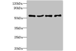 Western blot All lanes: UBA5 antibody at 6 μg/mL Lane 1: Jurkat whole cell lysate Lane 2: Hela whole cell lysate Lane 3: HepG2 whole cell lysate Lane 4: Caco-2 whole cell lysate Secondary Goat polyclonal to rabbit IgG at 1/10000 dilution Predicted band size: 45, 39 kDa Observed band size: 45 kDa (UBA5 Antikörper  (AA 291-404))