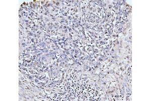 IHC analysis of KIFC1 using anti-KIFC1 antibody (ABIN7599523). (KIFC1 Antikörper  (AA 1-673))
