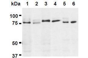 Western Blotting (WB) image for anti-UV Radiation Resistance Associated Gene (UVRAG) (AA 389-699) antibody (ABIN1449295) (UVRAG Antikörper  (AA 389-699))