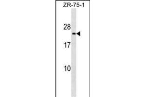 TMED3 Antibody (C-term) (ABIN1536734 and ABIN2849106) western blot analysis in ZR-75-1 cell line lysates (35 μg/lane). (TMED3 Antikörper  (C-Term))