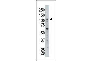 Image no. 1 for anti-Hexokinase 2 (HK2) (N-Term) antibody (ABIN360640)