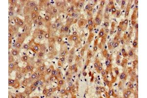 Immunohistochemistry of paraffin-embedded human liver tissue using ABIN7144576 at dilution of 1:100 (ARFIP2 Antikörper  (AA 20-295))
