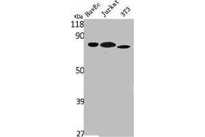 Western Blot analysis of HuvEc Jurkat NIH-3T3 cells using Ezrin Polyclonal Antibody (Ezrin Antikörper  (C-Term))