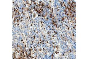 IHC analysis of ANGPTL4 using anti-ANGPTL4 antibody (ABIN5518734).