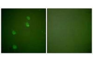 Immunofluorescence analysis of NIH/3T3 cells, using Cullin 2 antibody. (Cullin 2 Antikörper)