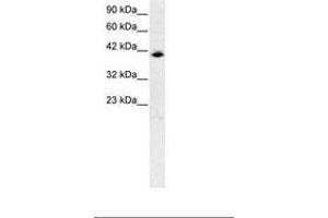 Image no. 1 for anti-Interferon Regulatory Factor 9 (IRF9) (AA 41-90) antibody (ABIN6735770) (IRF9 Antikörper  (AA 41-90))