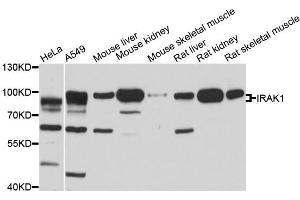 Western blot analysis of extracts of various cell lines, using IRAK1 antibody. (IRAK1 Antikörper)