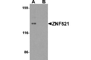 Western blot analysis of ZNF521 in HeLa cell lysate with ZNF521 antibody at 1 µg/mL in (A) the absence and (B) the presence of blocking peptide. (ZNF521 Antikörper  (N-Term))