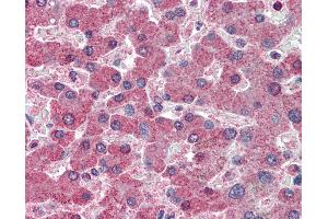 anti-Retinol Binding Protein 4, Plasma (RBP4) (AA 19-202) antibody