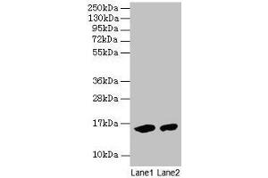 Western blot All lanes: Mouse Hemoglobin antibody at 2 μg/mL Lane 1: Mouse serum at 1: 100 Lane 2: Mouse serum at 1: 1000 Secondary Goat polyclonal to rabbit IgG at 1/15000 dilution Predicted band size: 16 kDa Observed band size: 16 kDa (Hemoglobin Antikörper)