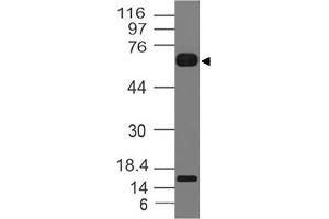 Image no. 1 for anti-Interleukin 1 Receptor-Like 2 (IL1RL2) (AA 1-203) antibody (ABIN5027304) (IL1RL2 Antikörper  (AA 1-203))