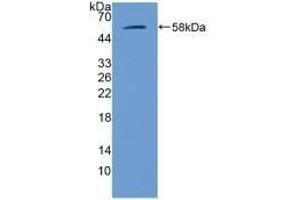 Detection of Recombinant GbA, Mouse using Polyclonal Antibody to Glucocerebrosidase (GBA) (GBA Antikörper  (AA 255-509))
