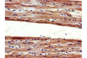 Immunohistochemistry (IHC) image for anti-Angiotensin II Receptor, Type 1 (AGTR1) (AA 306-356) antibody (ABIN7173980)