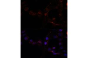 Immunofluorescence analysis of  cells using C antibody (ABIN7266034) at dilution of 1:100. (Calpain 7 Antikörper  (AA 20-220))