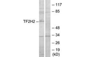 Western blot analysis of extracts from COLO205 cells, using TF2H2 Antibody.