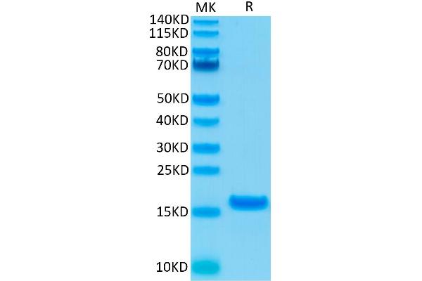 IL-21 Protein