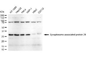 anti-Synaptosomal-Associated Protein, 29kDa (SNAP29) antibody