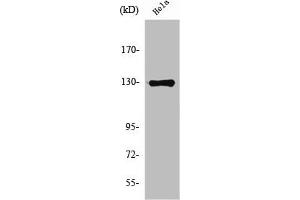 Western Blot analysis of HeLa cells using NOS2 Polyclonal Antibody (NOS2 Antikörper  (C-Term))
