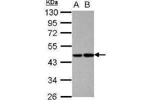 WB Image Sample (30 ug of whole cell lysate) A: HepG2 B: HCT116 10% SDS PAGE antibody diluted at 1:1000 (PROC Antikörper)
