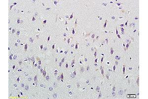 Formalin-fixed and paraffin embedded mouse kidney labeled with Anti-CUEDC2/CUE domain containing 2 Polyclonal Antibody, Unconjugated (ABIN707531) at 1:300 followed by conjugation to the secondary antibody and DAB staining (CUEDC2 Antikörper  (AA 201-287))