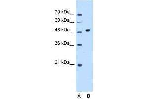 WB Suggested Anti-GTDC1 Antibody Titration:  0. (GTDC1 Antikörper  (N-Term))