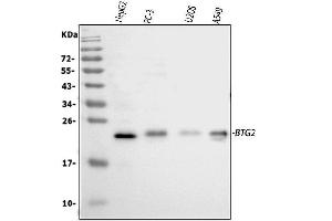 Western blot analysis of BTG2 using anti-BTG2 antibody (ABIN5692800). (BTG2 Antikörper)