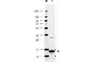 Image no. 1 for anti-Colony Stimulating Factor 2 (Granulocyte-Macrophage) (CSF2) antibody (ABIN401109) (GM-CSF Antikörper)