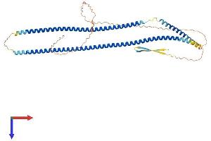 KRT14 Protein (AA 1-484) (His tag)