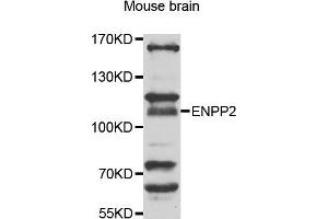 Western Blotting (WB) image for anti-Ectonucleotide Pyrophosphatase/phosphodiesterase 2 (ENPP2) (AA 564-863) antibody (ABIN6219607) (ENPP2 Antikörper  (AA 564-863))