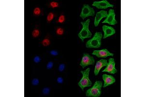 ABIN7094825 and ABIN7098876 staining Hela cells by IF/ICC. (RECQL5 Antikörper  (C-Term))