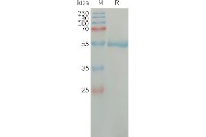 Complement Factor D (CFD) (AA 26-253) protein (Fc Tag)