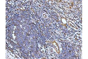 IHC analysis of Filamin B/FLNB using anti-Filamin B/FLNB antibody (ABIN7601606).