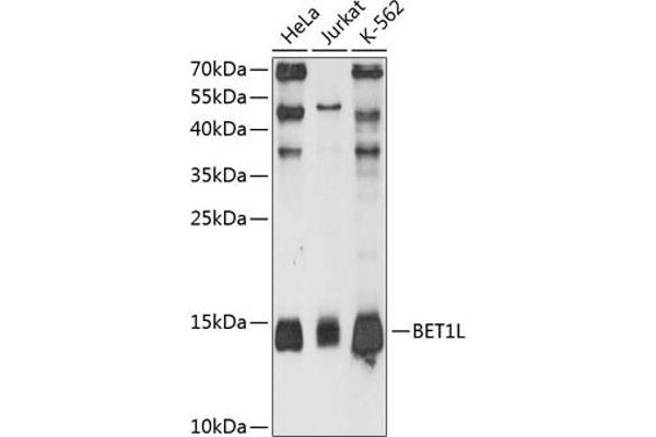 BET1L Antikörper  (AA 1-60)
