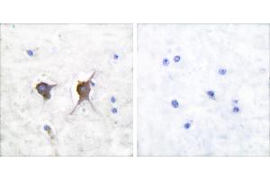 Peptide - +Immunohistochemical analysis of paraffin-embedded human brain tissue using Bax antibody (#C0132). (BAX Antikörper)