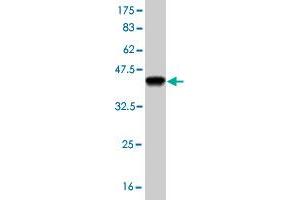 Western Blot detection against Immunogen (37. (PLD1 Antikörper  (AA 965-1074))