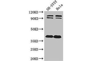 Western Blot Positive WB detected in: SH-SY5Y whole cell lysate, Hela whole cell lysate All lanes: DISC1 antibody at 2 μg/mL Secondary Goat polyclonal to rabbit IgG at 1/50000 dilution Predicted band size: 94, 92, 74, 39, 83, 63, 61, 76, 73, 38, 22 kDa Observed band size: 94, 92, 38 kDa (DISC1 Antikörper  (AA 99-325))