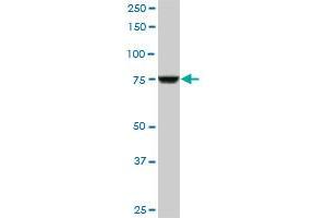 Western Blotting (WB) image for anti-Cleavage and Polyadenylation Specific Factor 3, 73kDa (CPSF3) (AA 585-684) antibody (ABIN526864)