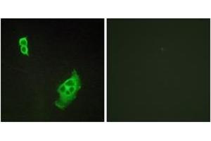 Immunofluorescence analysis of COS7 cells, using WAVE1 (Ab-125) Antibody. (WASF1 Antikörper  (AA 91-140))