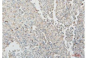IHC analysis of COMT using anti-COMT antibody (ABIN7601948). (COMT Antikörper  (AA 52-271))
